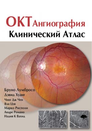 Optometriya