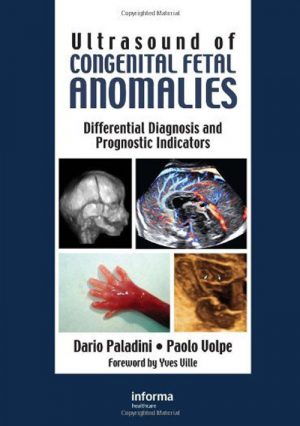 Ultrasound Of Congenital Fetal Anomalies. Differential Diagnosis And Prognostic Indicators