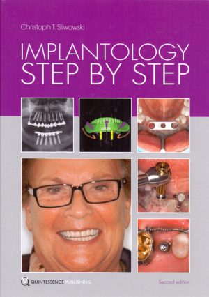 Implantology Step By Step