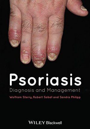 Psoriasis. Diagnosis And Management
