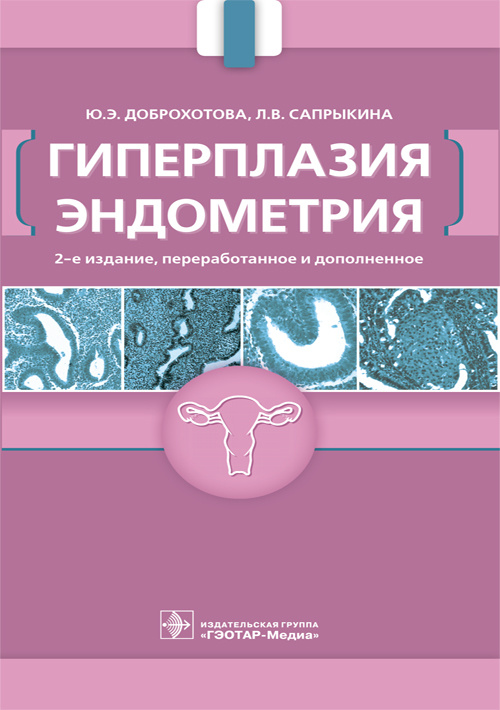 Гиперплазия эндометрия (уценка 70)