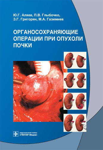 Органосохраняющие операции при опухоли почки