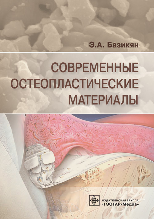 Современные остеопластические материалы (уценка 70)