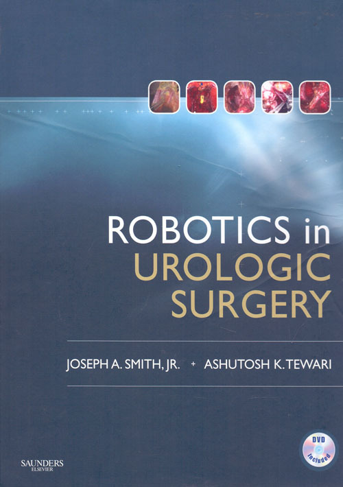 Robotics In Urologic Surgery (Роботизация в оперативной урологии)