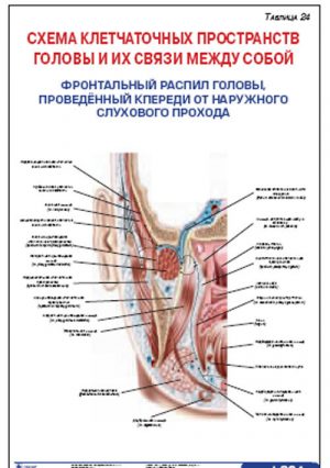 Плакат “Схема клетчаточных пространств головы и их связи между собой. Фронтальный распил головы, проведенный кпереди от наружного слухового прохода” (
