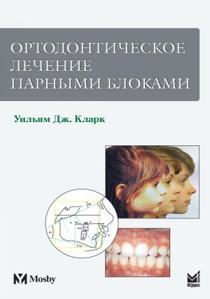 Ортодонтическое лечение парными блоками