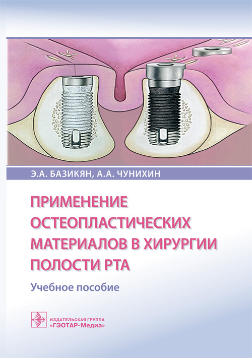 Применение остеопластических материалов в хирургии полости рта (уценка 40)
