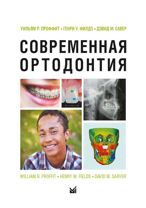 Современная ортодонтия