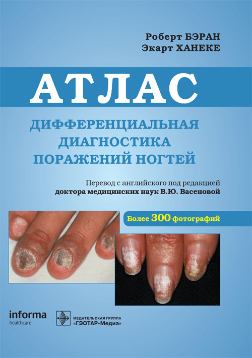 Дифференциальная диагностика поражений ногтей. Атлас