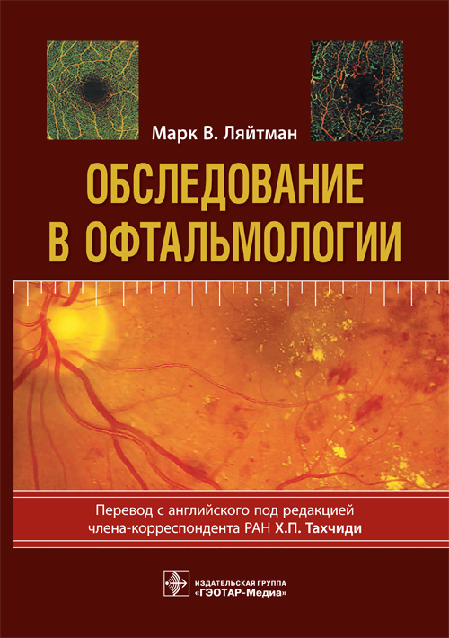 Обследование в офтальмологии (уценка 40)