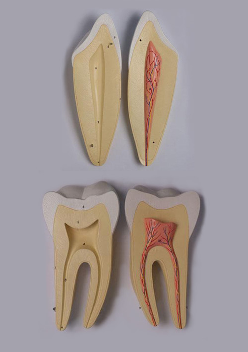 Патологии зубов. Увеличение в 4 раза