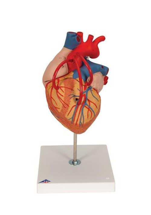 Модель сердца с анастомозами. Увеличение в 2 раза. 4 части