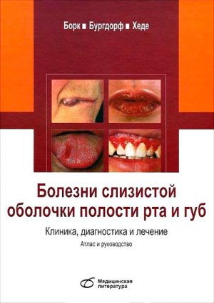 Болезни слизистой оболочки полости рта и губ. Клиника, диагностика и лечение. Атлас