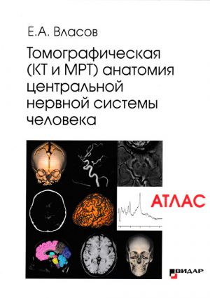 Томографическая (КТ и МРТ) анатомия центральной нервной системы человека