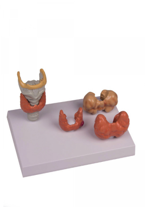 Набор моделей, демонстрирующих заболевание щитовидной железы