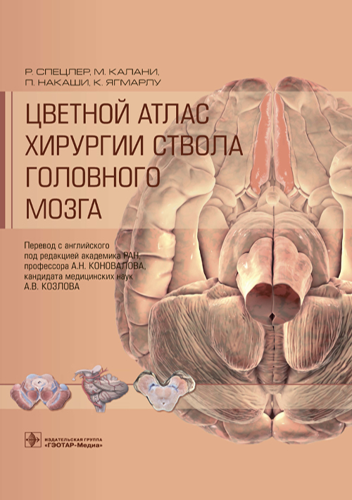 Цветной атлас хирургии ствола головного мозга