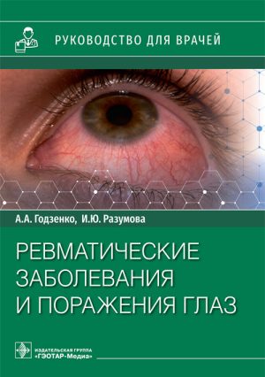Ревматические заболевания и поражения глаз. Руководство(электронный выпуск)