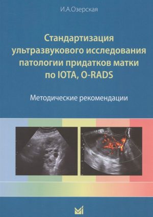 Стандартизация ультразвукового исследования патологии придатков матки по IOTA, O-RADS. Методические рекомендации