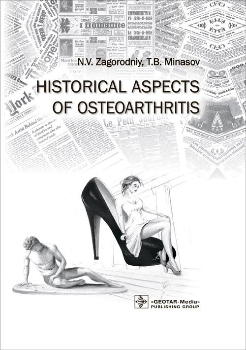 Historical Aspects Of Osteoarthritis