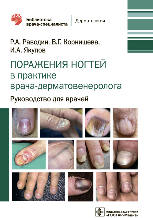 Поражения ногтей в практике врача-дерматовенеролога. Руководство