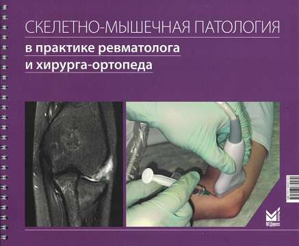 Скелетно-мышечная патология в практике ревматолога и хирурга-ортопеда. Краткое иллюстрированное руководство