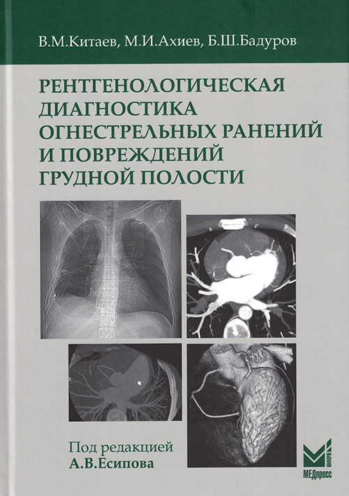 Рентгенологическая диагностика огнестрельных ранений и повреждений грудной полости