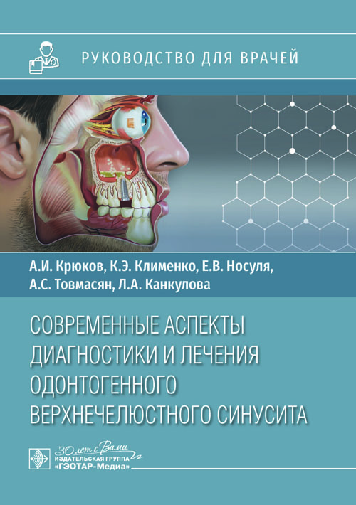 Современные аспекты диагностики и лечения одонтогенного верхнечелюстного синусита. Руководство