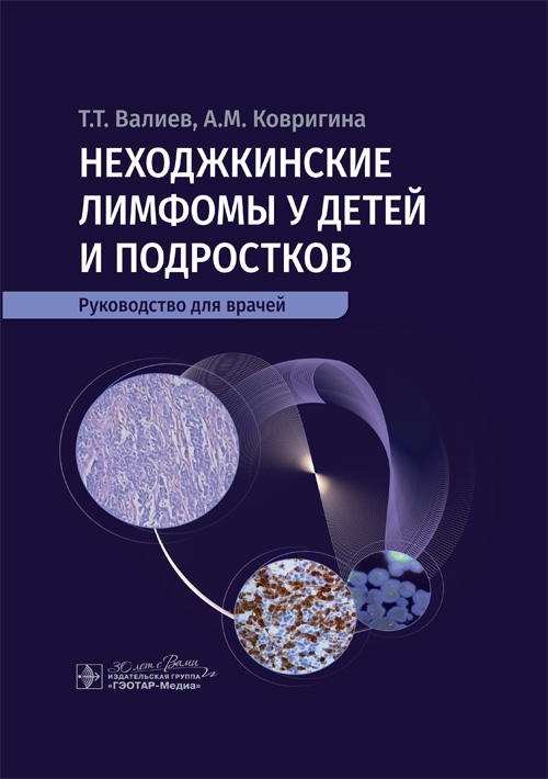 Неходжкинские лимфомы у детей и подростков. Руководство для врачей