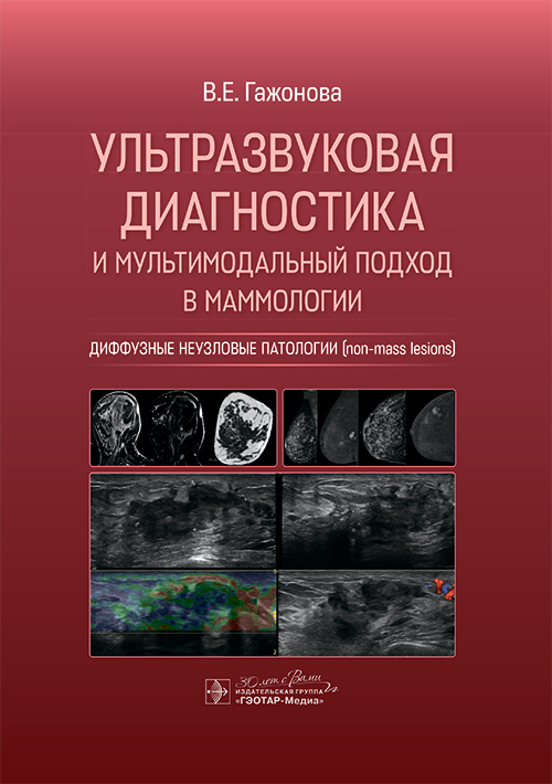 Ультразвуковая диагностика и мультимодальный подход в маммологии. Диффузные неузловые патологии (non-mass Lesions)