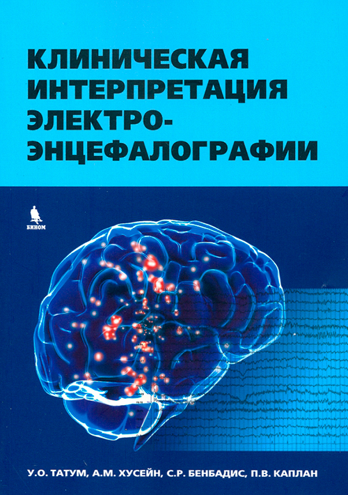 Клиническая интерпретация электроэнцефалографии