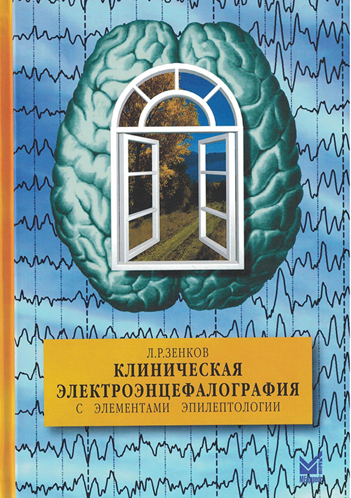 Клиническая электроэнцефалография (с элементами эпилептологии). Руководство для врачей