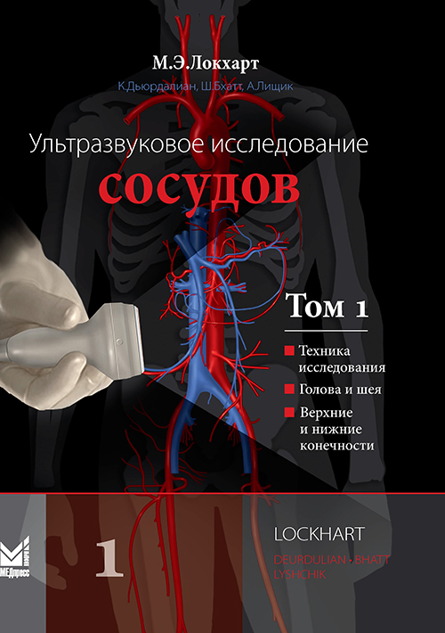 Ультразвуковое исследование сосудов. В 2-х томах. Том 1