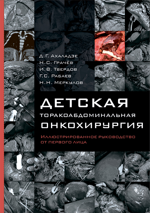 Детская торакоабдоминальная онкохирургия. Иллюстрированное руководство от первого лица