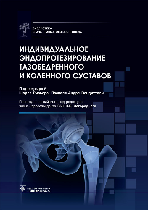 Индивидуальное эндопротезирование тазобедренного и коленного суставов (уценка 10)