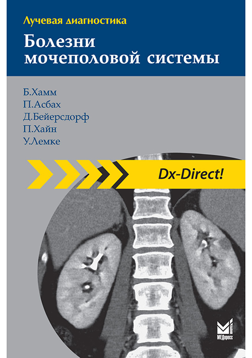 Лучевая диагностика. Болезни мочеполовой системы