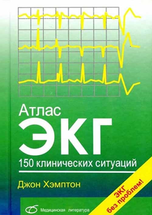 Атлас ЭКГ. 150 клинических ситуаций