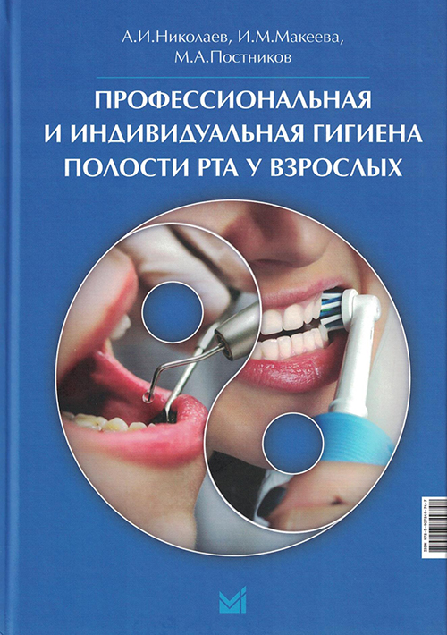 NF0030929