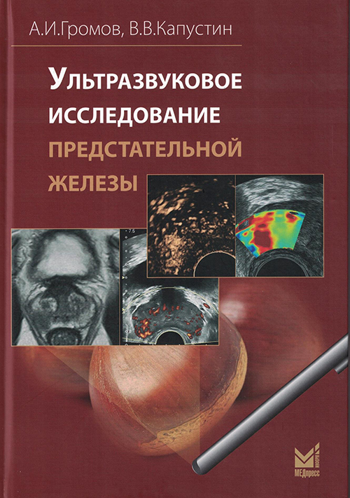 Ультразвуковое исследование предстательной железы