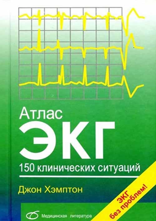 Атлас ЭКГ. 150 клинических ситуаций (уценка 50)