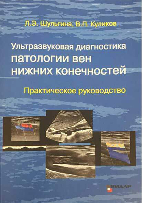 Ультразвуковая диагностика патологии вен нижних конечностей