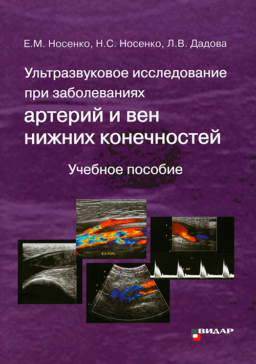 Ультразвуковое исследование при заболеваниях артерий и вен нижних конечностей