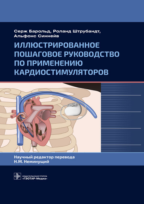 Иллюстрированное пошаговое руководство по применению кардиостимуляторов
