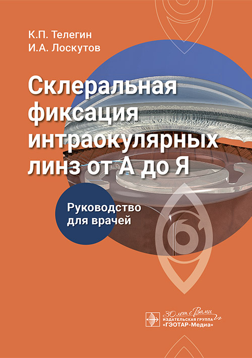 Склеральная фиксация интраокулярных линз от А до Я. Руководство для врачей (Эл.версия)
