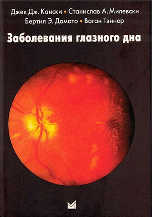 Заболевания глазного дна