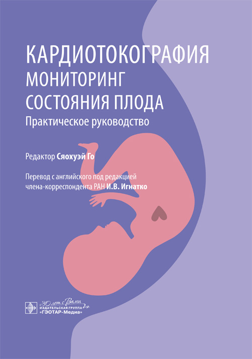 Кардиотокография. Мониторинг состояния плода. Практическое руководство