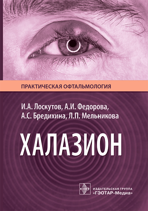 Халазион (эл.версия)