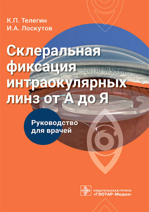 Склеральная фиксация интраокулярных линз от А до Я. Руководство (эл.версия)