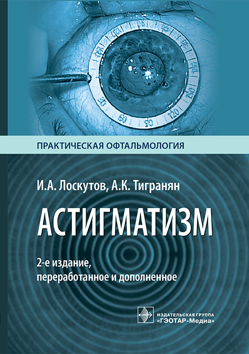 Астигматизм (эл.версия)