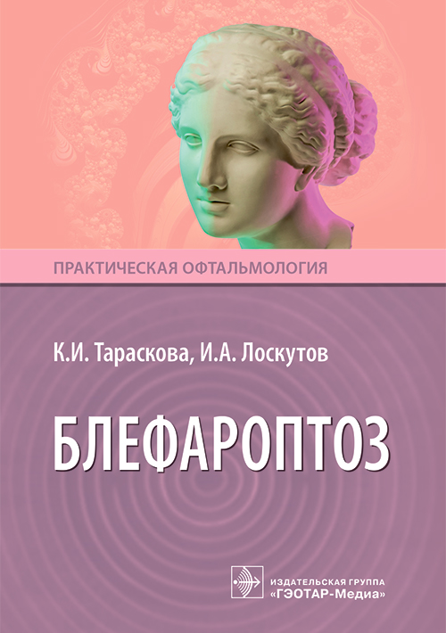 Блефароптоз