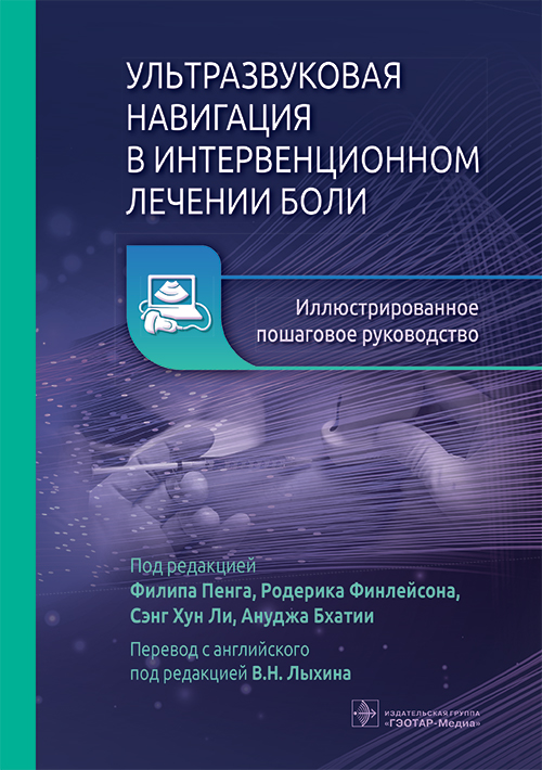 Ультразвуковая навигация в интервенционном лечении боли. Иллюстрированное пошаговое руководство